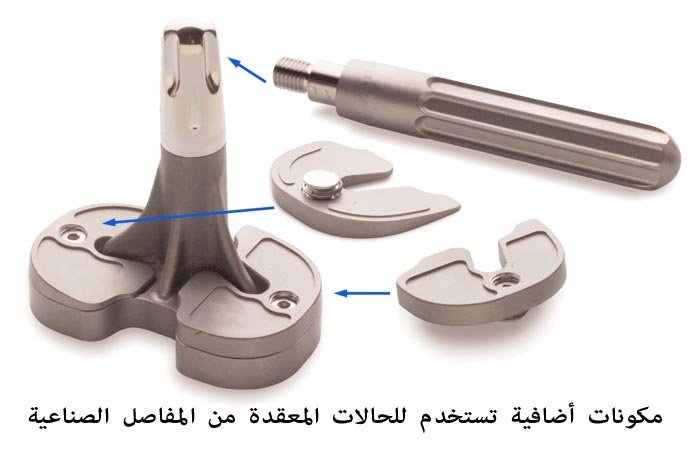 أجزاء إضافية للمفاصل الصناعية تزيد من تكلفة عملية تركيب ركبة 
