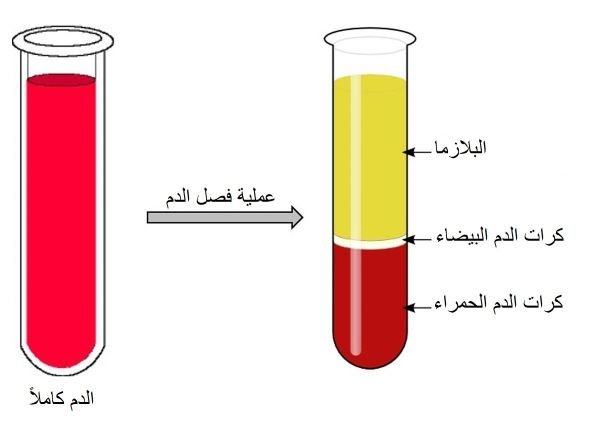 عملية فصل الدم باستخدام البلازما الغنية بالصفائح الدموية 