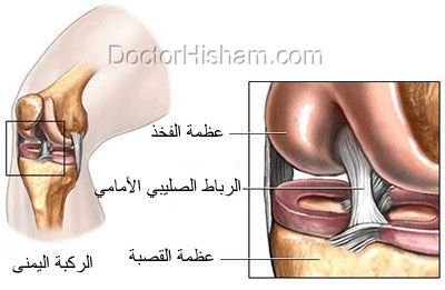 صورة توضيحية لمكان الرباط التصالبي داخل الركبة