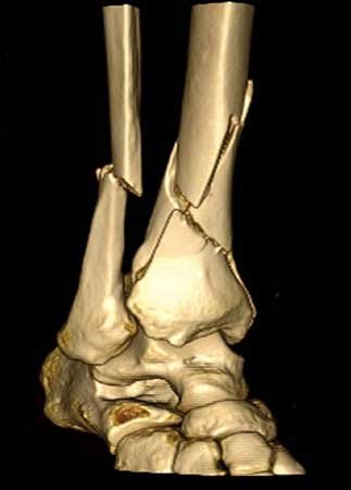 CT scan - Hip and Knee clinic