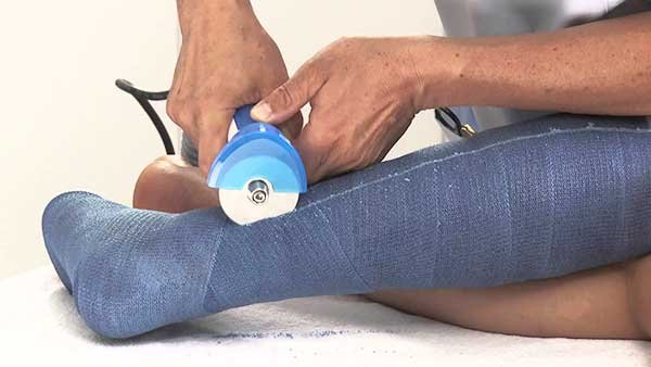 فك و رفع الجبس عيادة الركبة و الفخذ