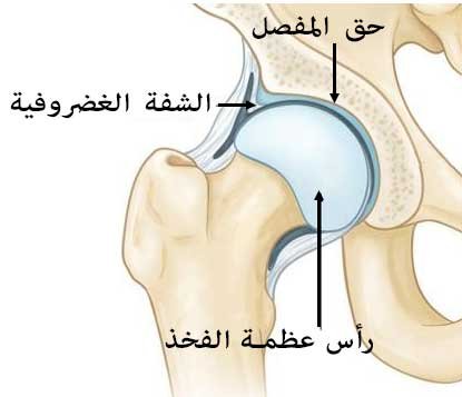  تمزق لشفة الغضروفية يؤدي لحدوث  طقطقة