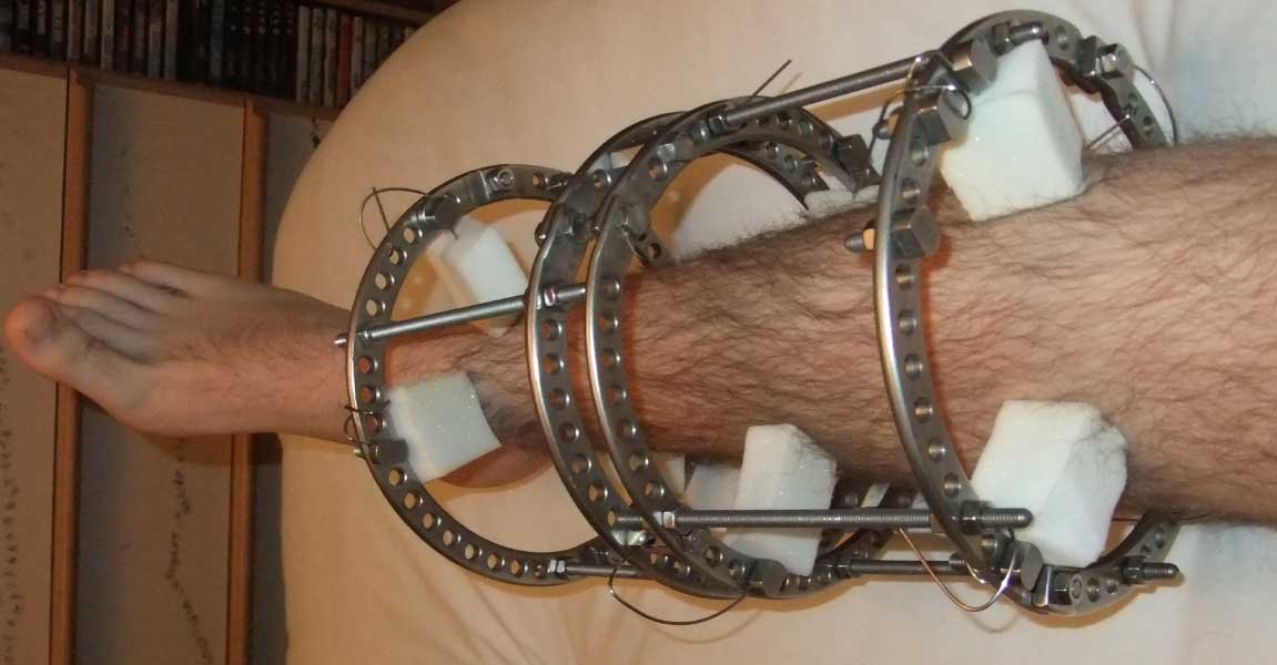 جهاز اليزاروف