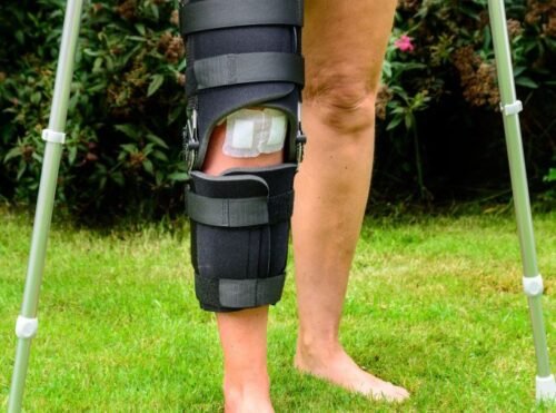 ركبة طبية داعمة وعكازات لمساعدة المريض على المشي بعد عملية الرباط الصليبي