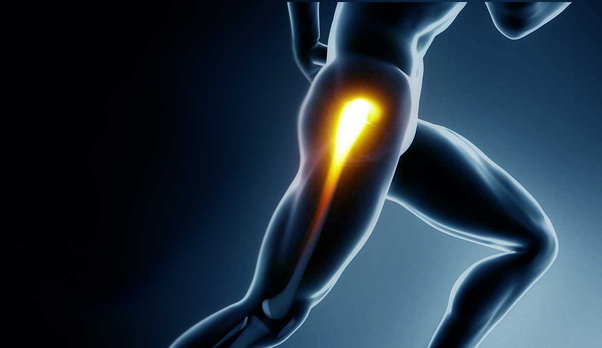 التهاب الكيس المدوري