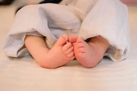 القدم المخلبية لحديثي الولادة
