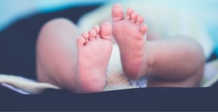 الأصابع المتراكبة عند الأطفال (أصابع الأطفال المتداخلة)
