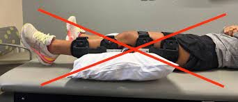 يجب عدم وضع وسادة تحت الركبة بعد جراحة الرباط الصليبي