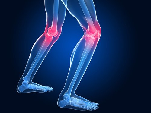 ألم خشونة الركبة يؤثر على جودة حياة المريض