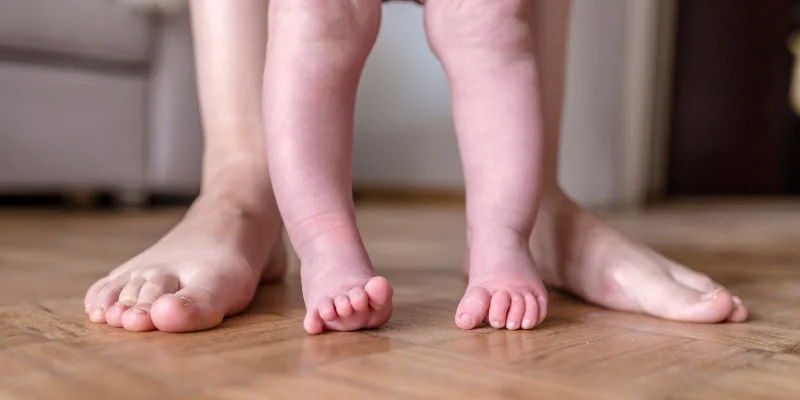 متى يحتاج طفلك لعلاج تقوس الساقين؟