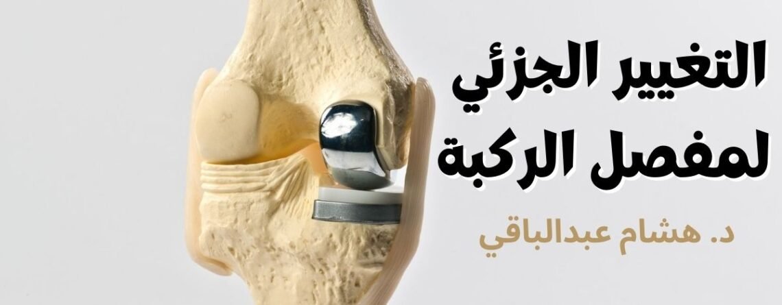 الاستبدال الجزئي للركبة