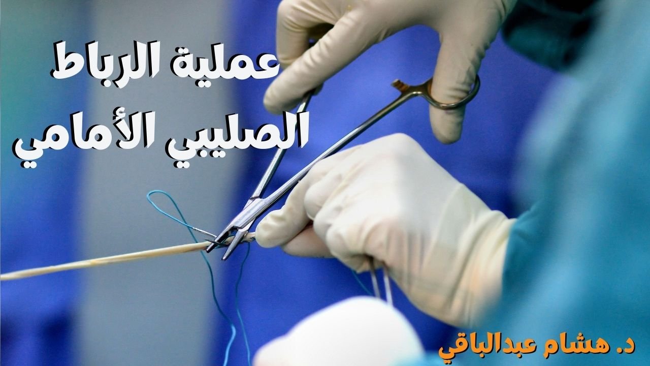 عملية الرباط الصليبي الأمامي