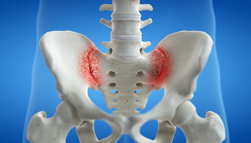 Sacroiliac joint