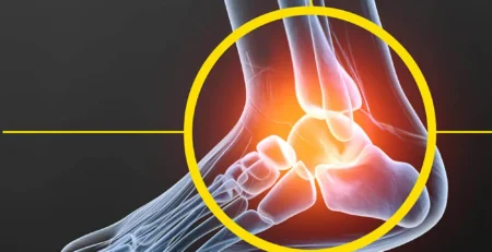 منظار الكاحل Ankle Arthroscopy