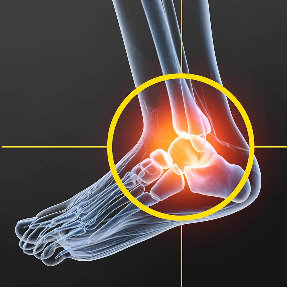 منظار الكاحل Ankle Arthroscopy