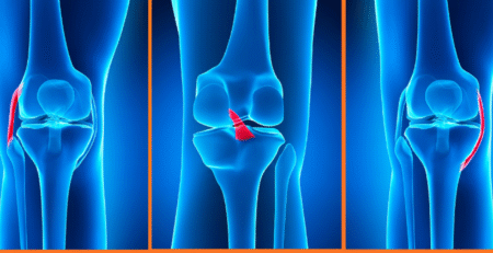 اعراض تمزق اربطة الركبة وعلاجها مع د. هشام عبد الباقي