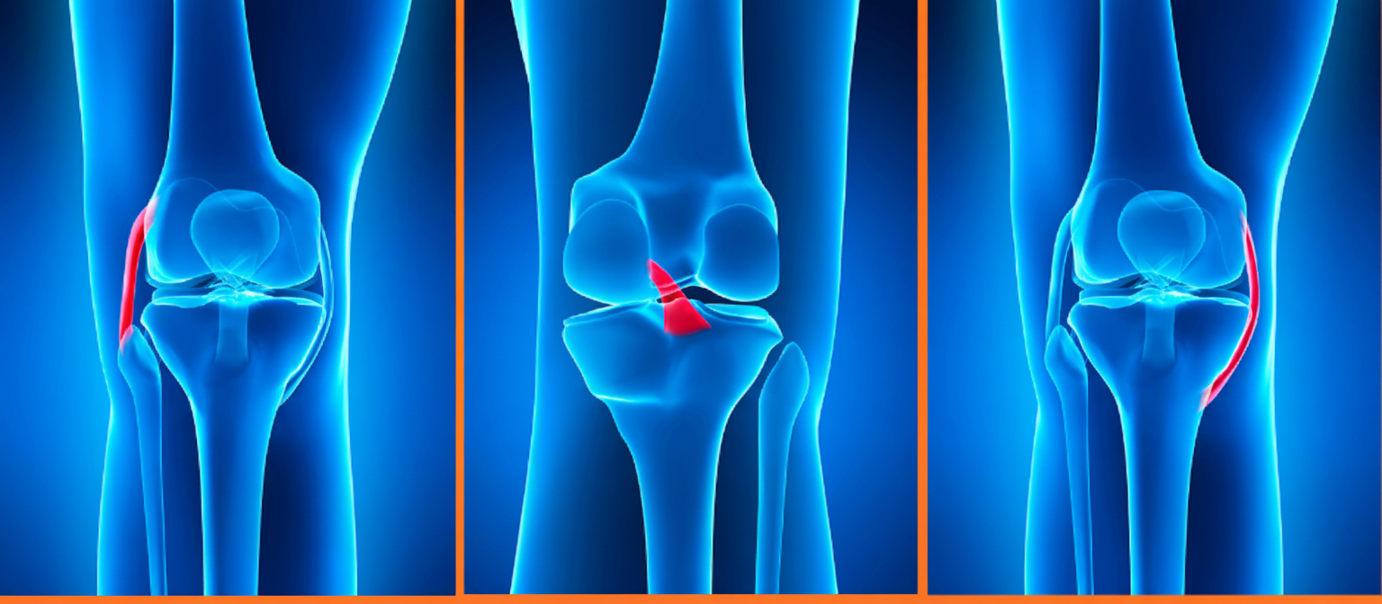 اعراض تمزق اربطة الركبة وعلاجها مع د. هشام عبد الباقي