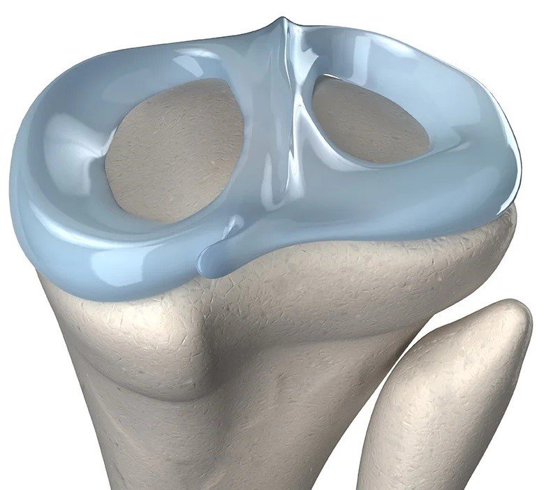 Meniscus cartilage الغضروف الهلالي