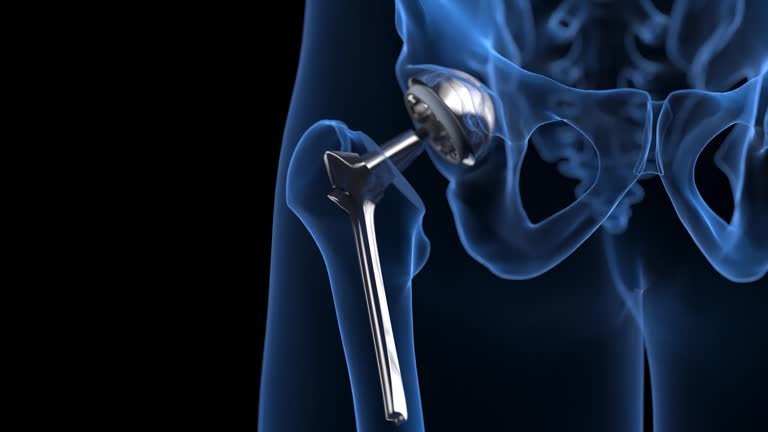 جراحات الفخذ