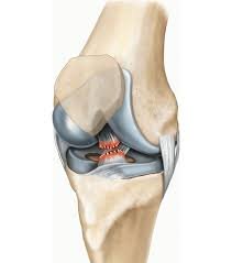 قطع الرباط الصليبي الامامي