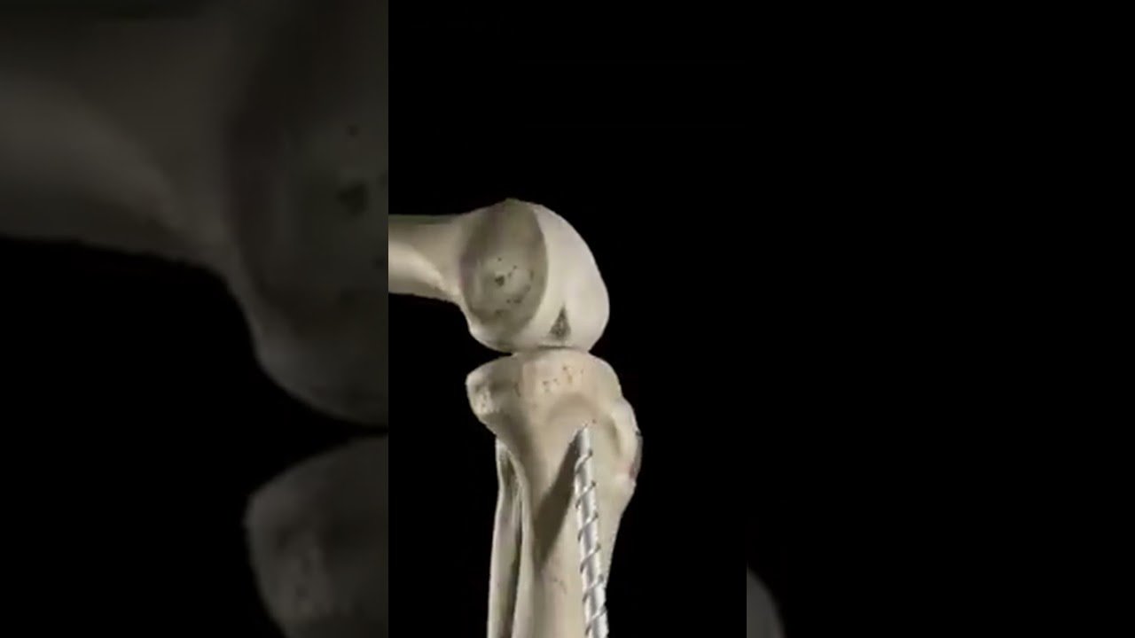 خياطة الرباط الصليبي