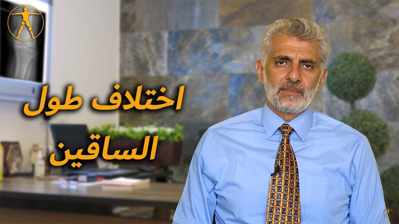 اختلاف طول الساقين