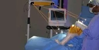 تقنية الإبحار الجراحي (Navigation)