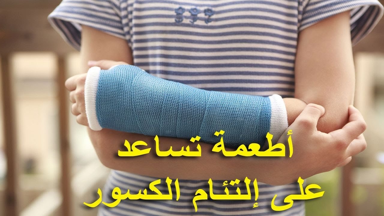 النظام الغذائي لكسر العظام