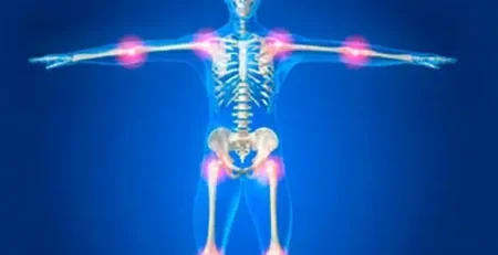 أمراض العظام