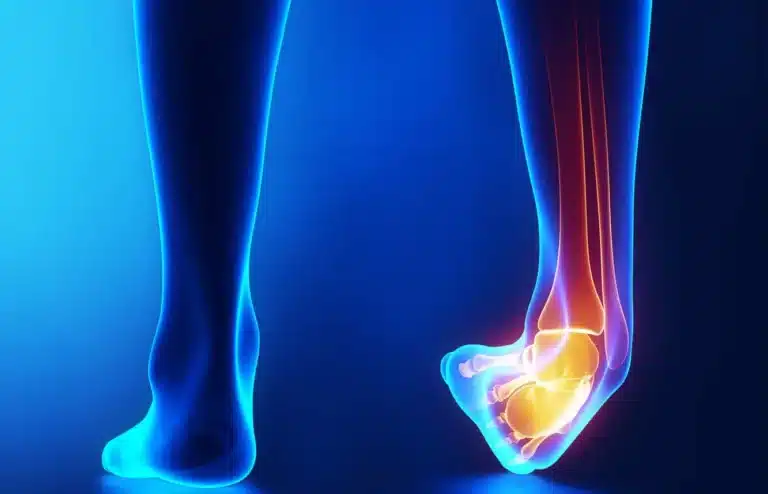 إصابات القدم الكاحل