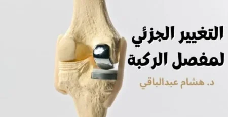 التغيير الجزئي لمفصل الركبة