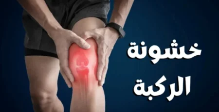 خشونة الركبة