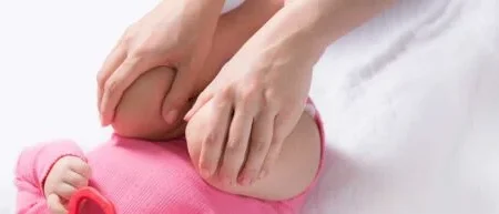 خلع الفخذ الولادي