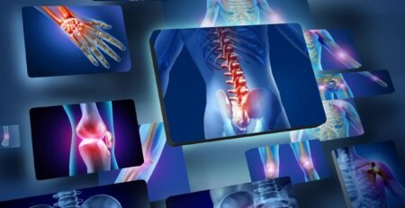 علاجات أمراض العظام