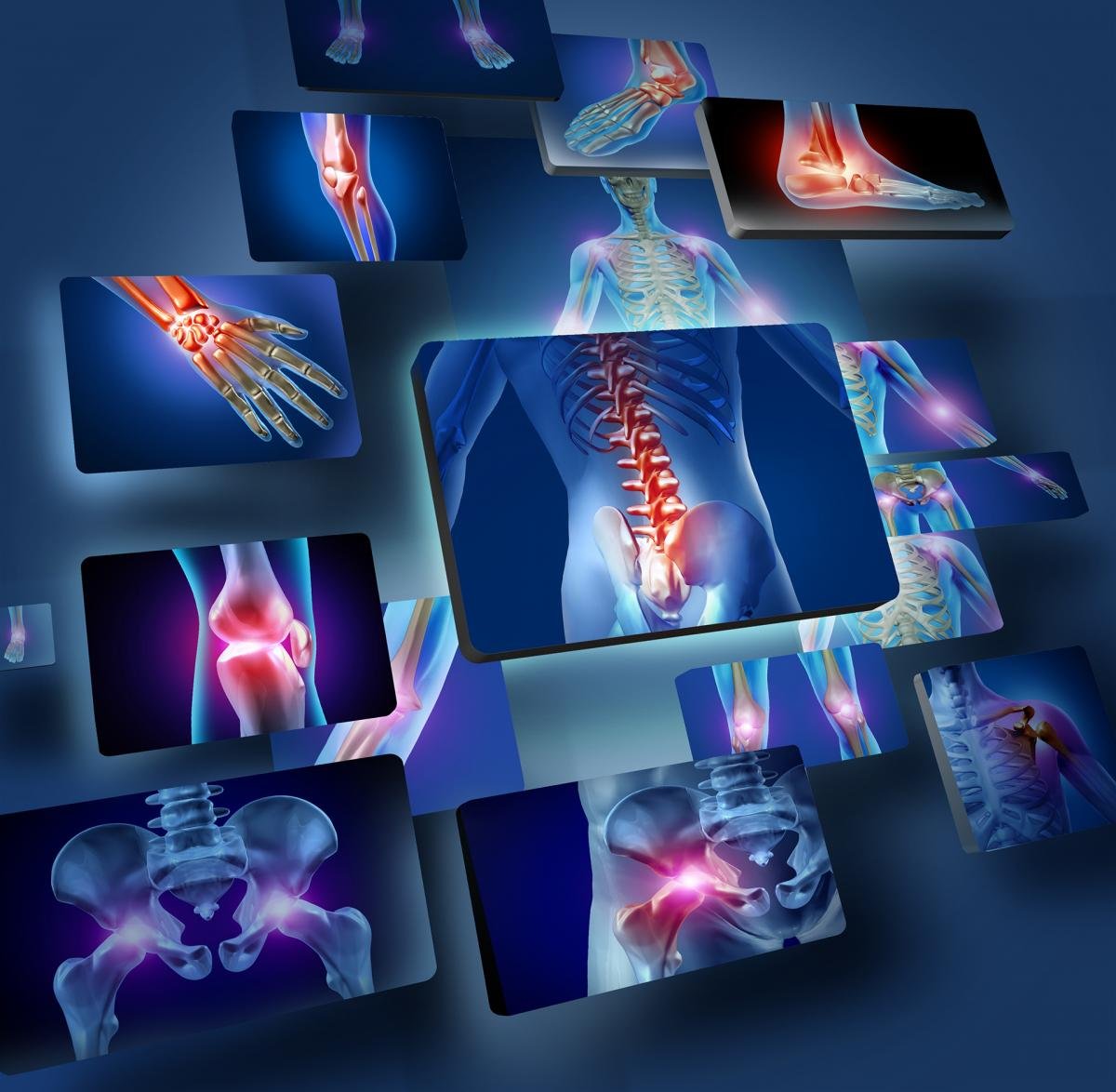 علاجات أمراض العظام