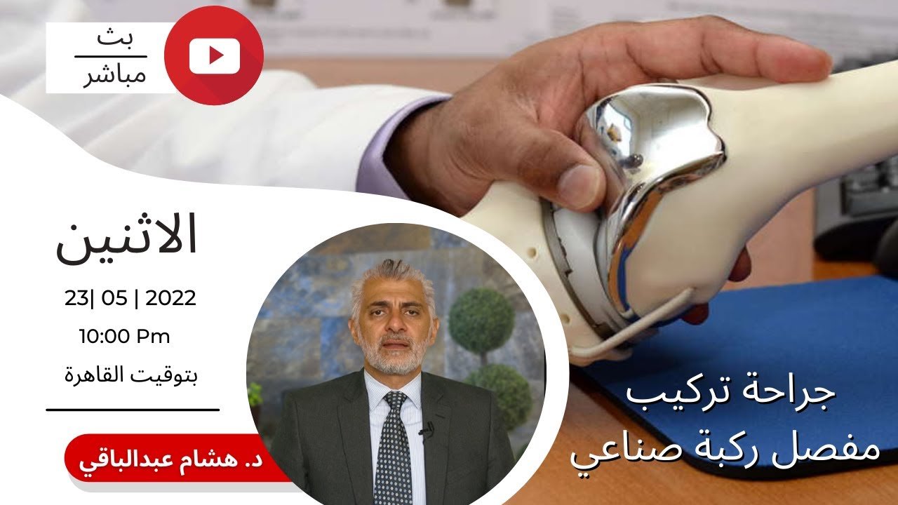 بث حي عن جراحة مفصل الركبة الصناعي
