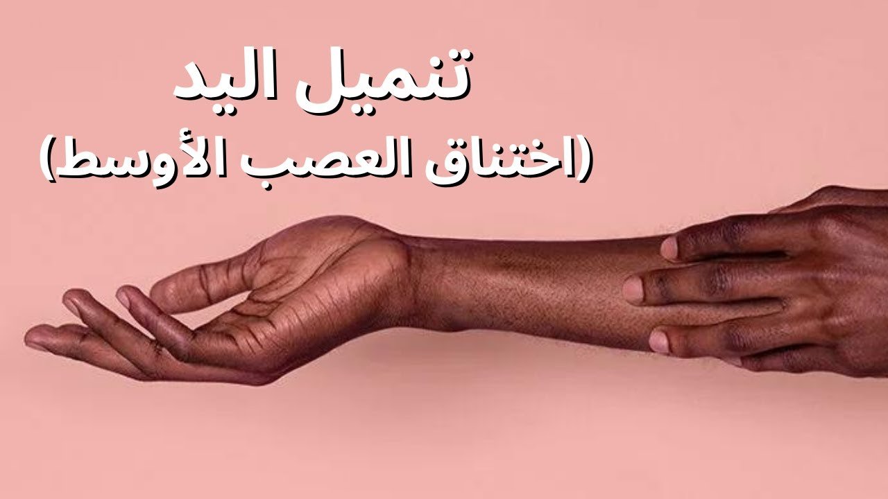 تنميل اليد ومتلازمة النفق الرسغي