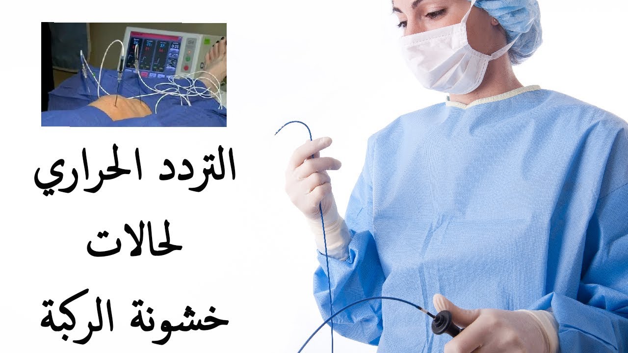 التردد الحراري لعلاج خشونة الركبة