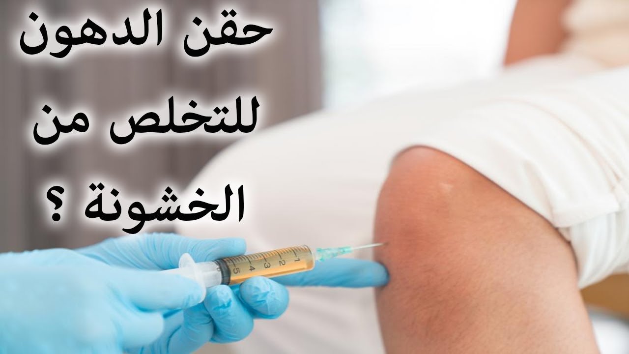 حقن الدهون لعلاج خشونة الركبة