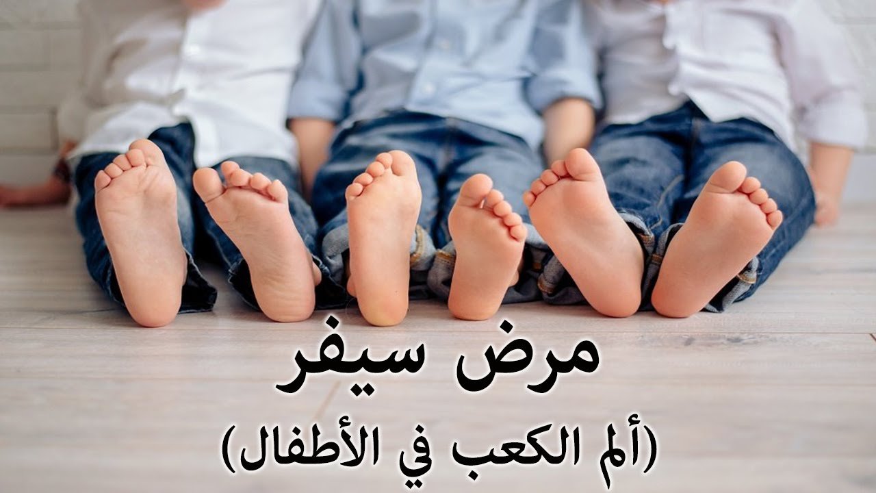 الم في كعب القدم عند الاطفال​