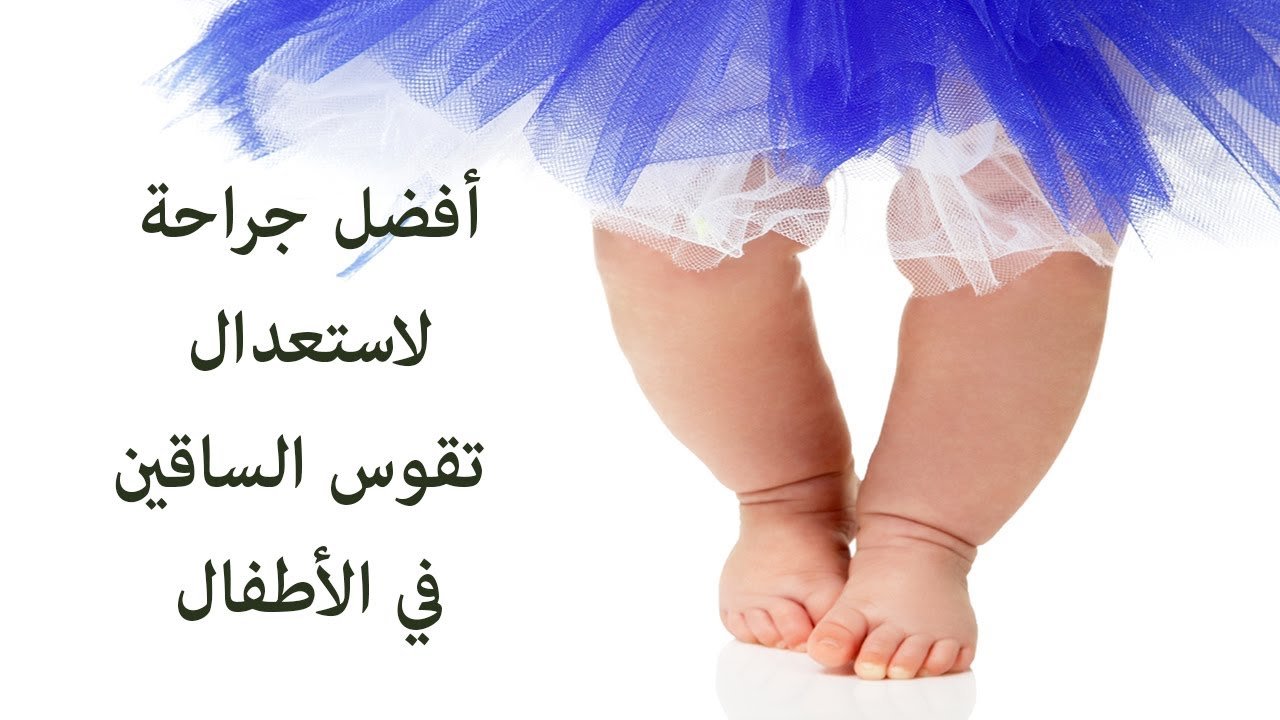 عملية تقوس الساقين للاطفال