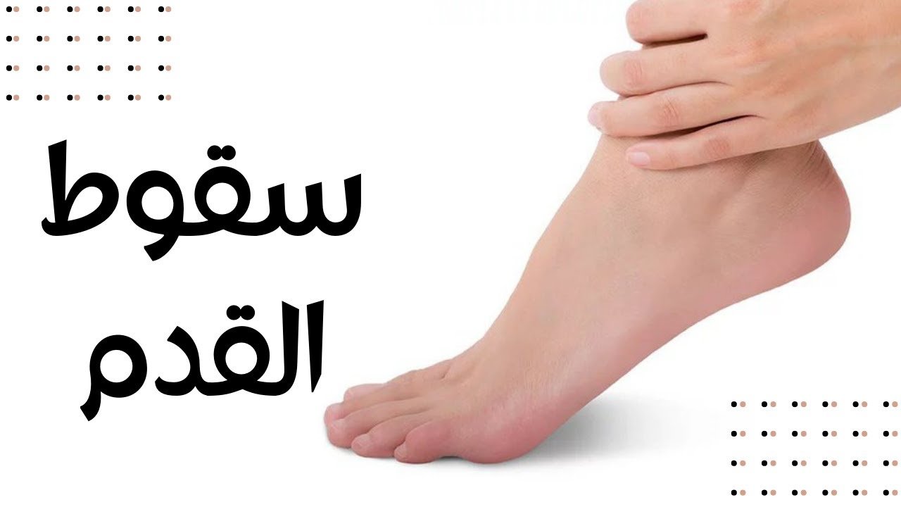 سقوط القدم