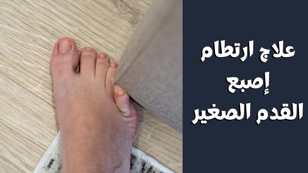 خبط اصبع القدم الصغير