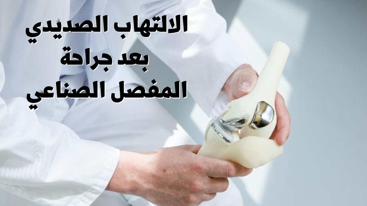 الالتهاب الصديدي بعد الجراحة