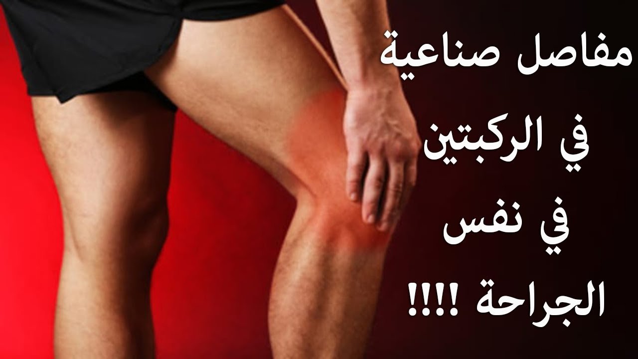 تركيب مفاصل صناعية فى الركبتين
