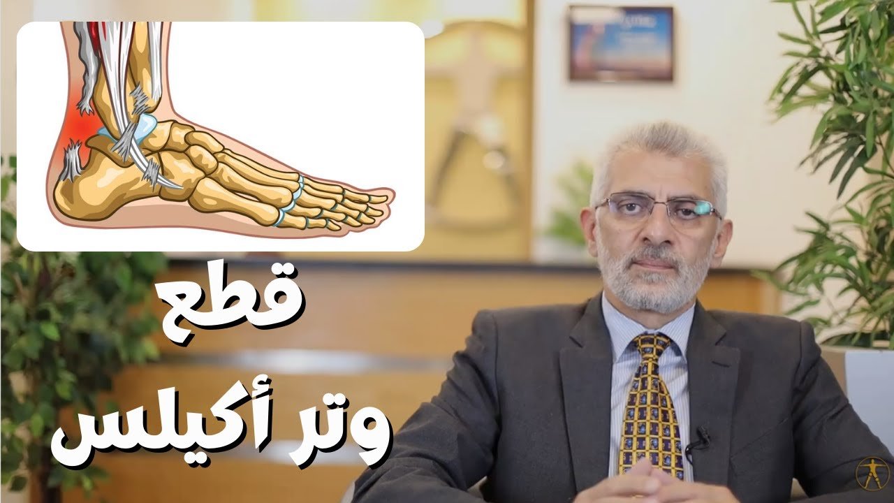 علاج تمزق وتر العرقوب​