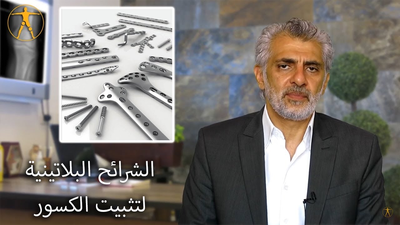 فيديو شرائح البلاتين تثبيت الكسور بشرائح البلاتين حقيقة أم خرافة؟