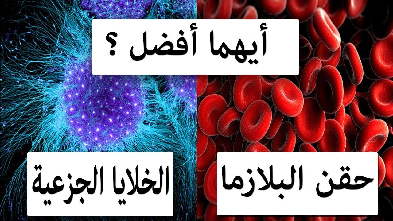 حقن البلازما للركبة