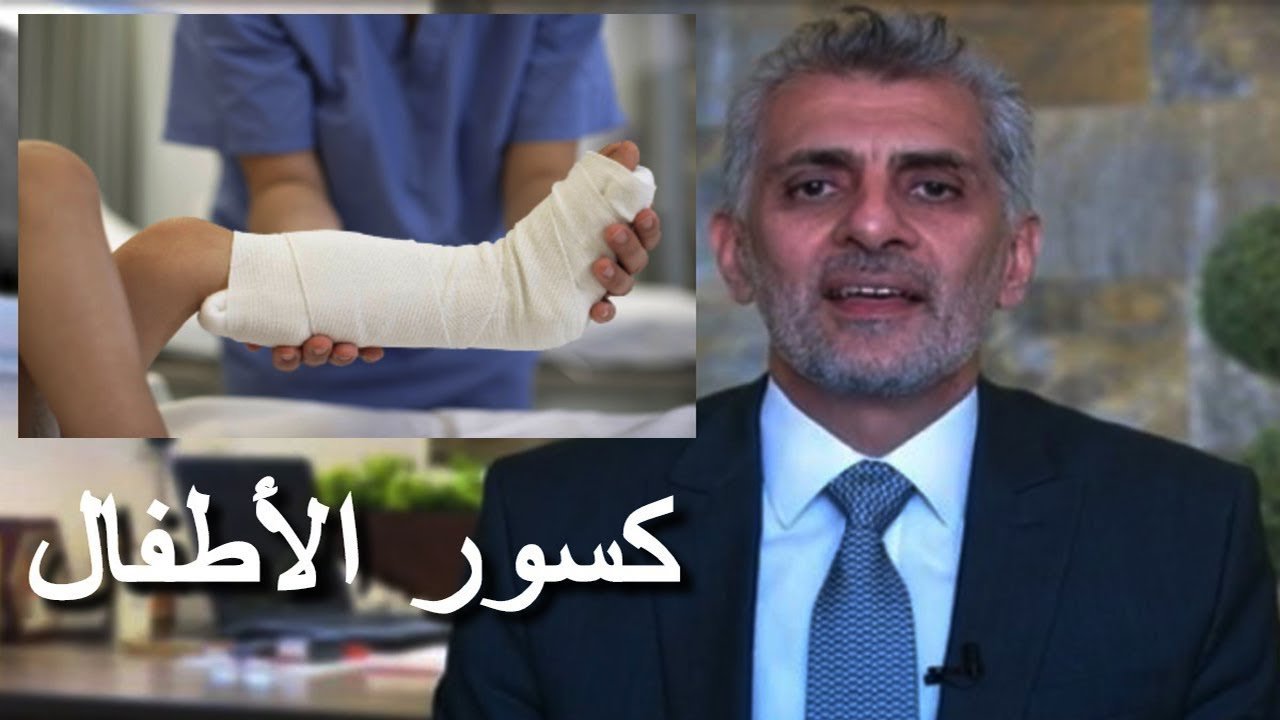 علاج كسور الاطفال
