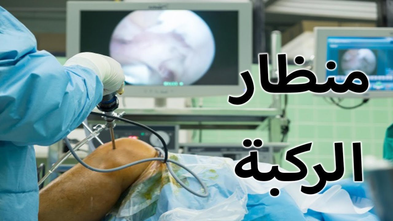 منظار الركبة